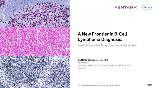 Un nuevo paradigma en el diagnóstico de linfoma: Kappa Lambda Dual ISH Un nuevo paradigma en el diagnóstico de linfoma: Kappa Lambda Dual ISH