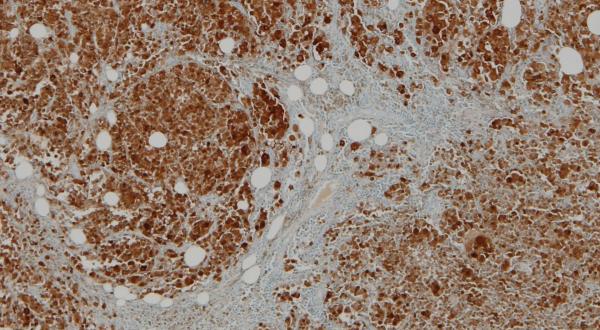 Anatomía Patológica