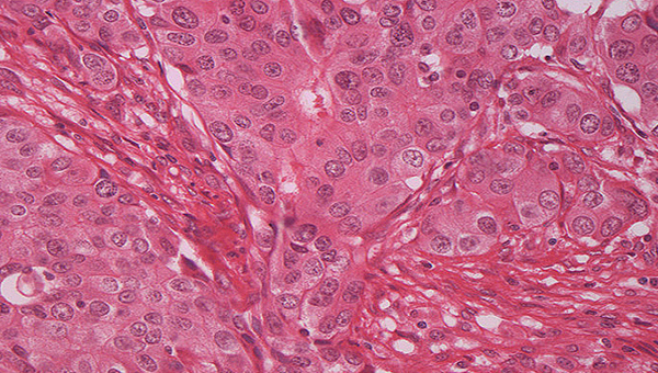 Introducción a la Anatomía Patológica