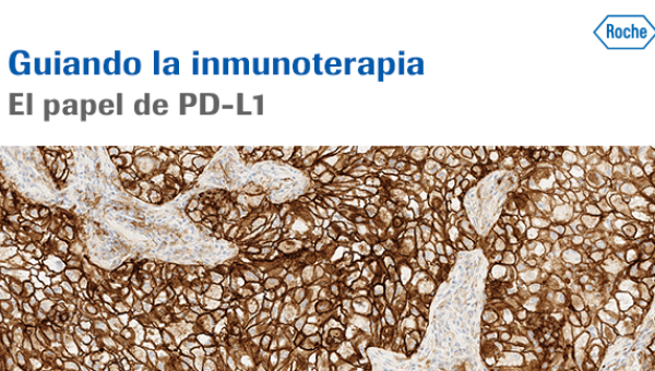 Video jornada de lanzamiento de PD-L1