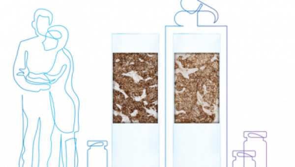 Aprendemos PD-L1 (SP263) en Cáncer de Pulmón - Guías, consejos y casos prácticos