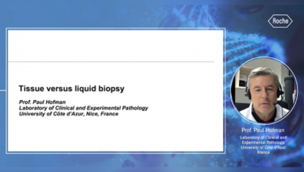 Biopsia de tejido contra Biopsia Líquida