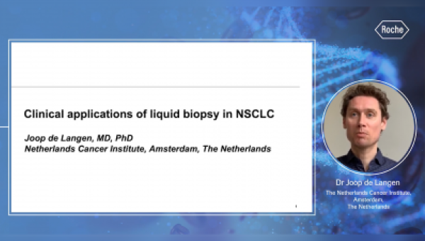 Aplicaciones clínicas actuales de la Biopsia Líquida en el cáncer de pulmón de células no pequeñas