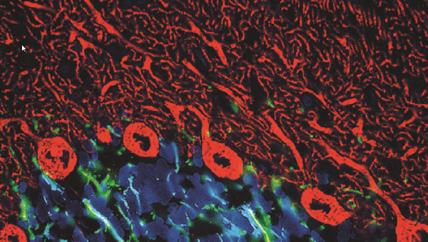 Utilidad Clínica de los marcadores tumorales [Estado actual y perspectivas de futuro III]