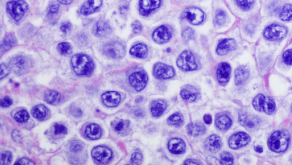 VPH y triaje en 2025: Claves para mejorar la practica clínica con tus pacientes VPH y triaje en 2025: Claves para mejorar la practica clínica con tus pacientes