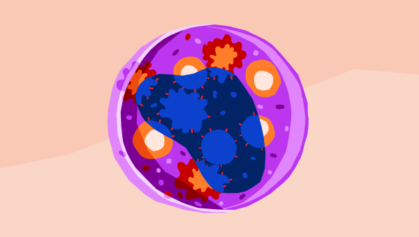 Abordaje de PIK3CA en cáncer de mama avanzado
